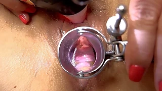 milf Doctor games! 1st Orgasm with a speculum in the cunt amateur